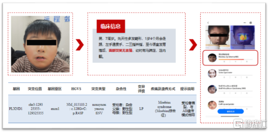 “AI+医疗”深度布局，贝康医疗(02170.HK)引领智慧医疗浪潮